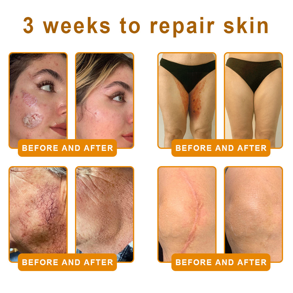 SEAGRIL®Bee Venom Cream – 🌸 Anti-Aging, Hydrating & Skin Repair