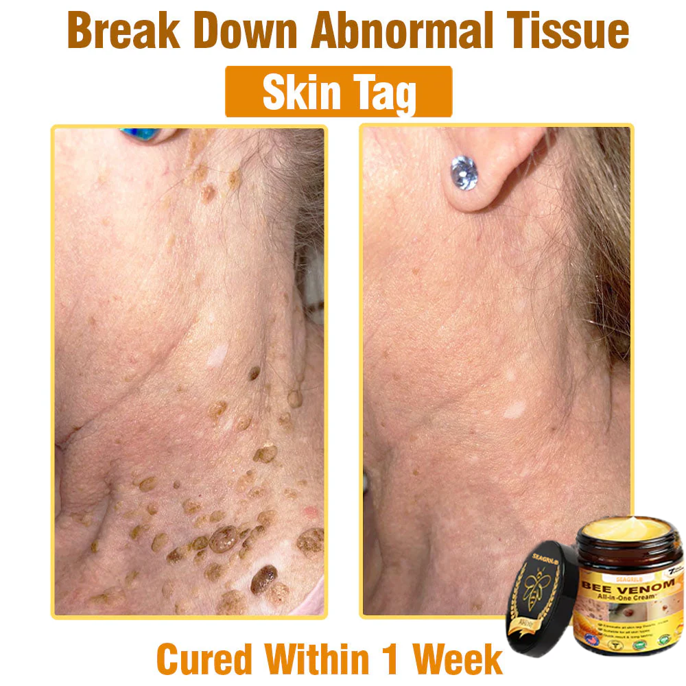 SEAGRIL®Bee Venom Cream – 🌸 Anti-Aging, Hydrating & Skin Repair