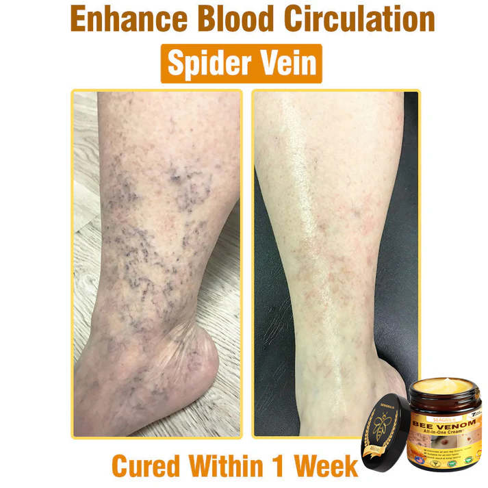 SEAGRIL®Bee Venom Cream – 🌸 Anti-Aging, Hydrating & Skin Repair