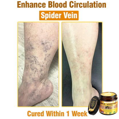 SEAGRIL®Bee Venom Cream – 🌸 Anti-Aging, Hydrating & Skin Repair