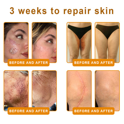 SEAGRIL®Bee Venom Cream – 🌸 Anti-Aging, Hydrating & Skin Repair