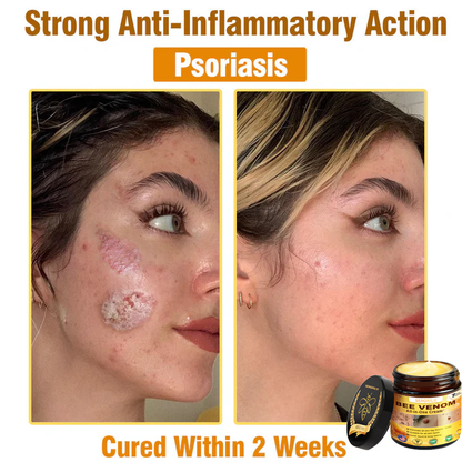 SEAGRIL®Bee Venom Cream – 🌸 Anti-Aging, Hydrating & Skin Repair