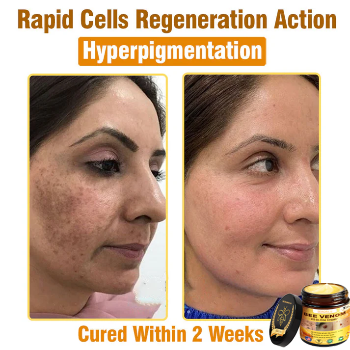 SEAGRIL®Bee Venom Cream – 🌸 Anti-Aging, Hydrating & Skin Repair