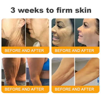 SEAGRIL®Bee Venom Cream – 🌸 Anti-Aging, Hydrating & Skin Repair
